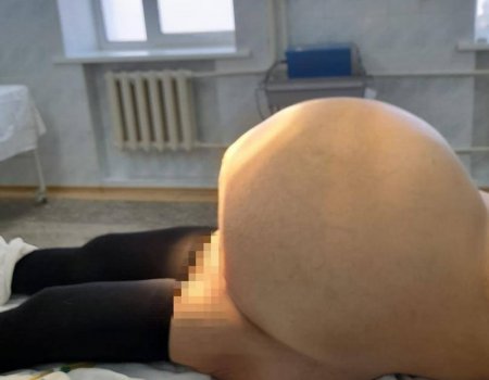 Это не фотошоп! В Башкирии у женщины удалили огромную опухоль яичника