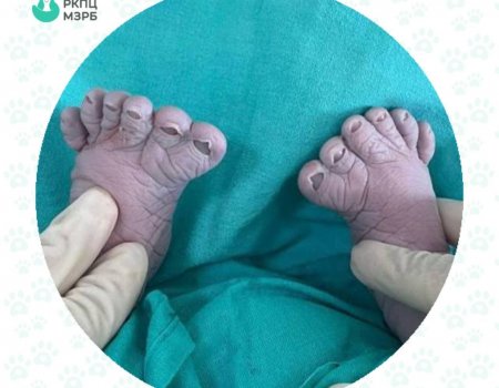 В Уфе женщина родила третьего ребенка с лишними пальчиками на ножках
