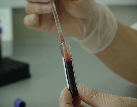 Уфимцам предлагают бесплатно пройти тест на свертываемость крови