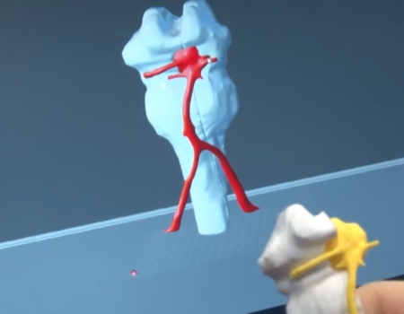 Башкирские инженеры и медики могут напечатать на 3D-принтере любой орган человека
