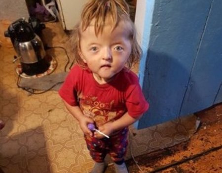 Радий Хабиров пообещал лично заняться судьбой двухлетней девочки-инвалида Софьи