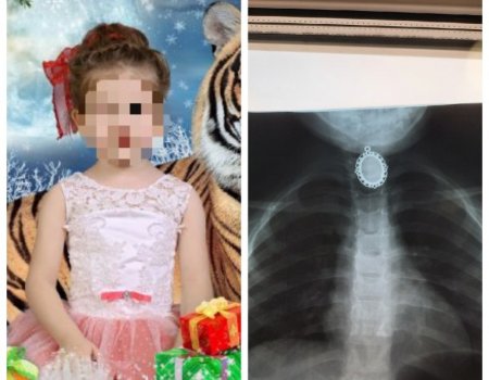 В Кумертау врачи спасли 4-летнюю девочку, проглотившую подвеску