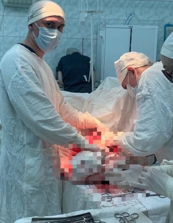 В Башкирии врачи экстренно прооперировали изувеченного бензопилой пациента
