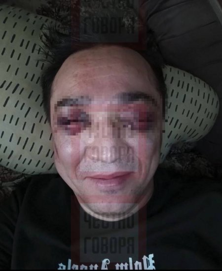В Башкирии пострадавший в массовой драке в кафе сообщил подробности конфликта