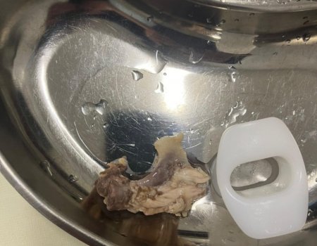 В Уфе врачи удалили застрявшую в пищеводе пациента кость курицы