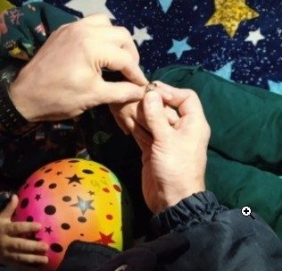 В Уфе спасли палец ребёнка от импровизированного кольца